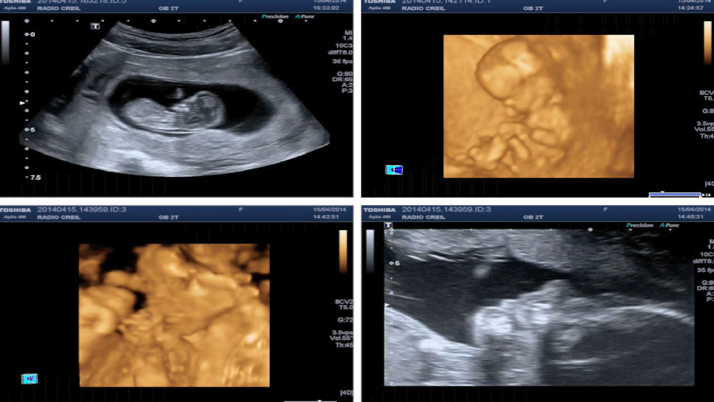 Echographie – Centre d'imagerie médicale de Creil Echographie – Centre d'imagerie médicale de Creil